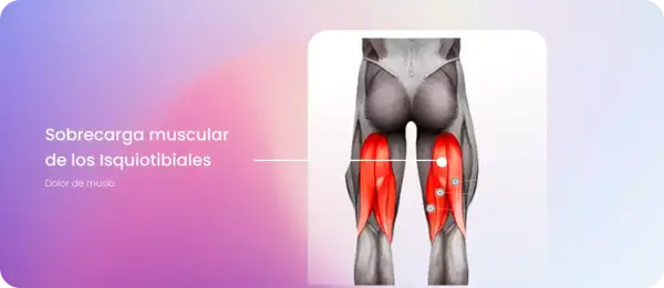 Anatomía de la pierna mostrando la sobrecarga muscular de los isquiotibiales, con los músculos resaltados en rojo.