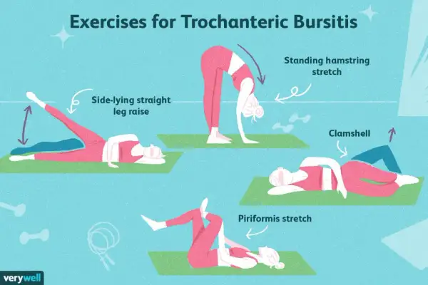 Ilustración muestra ejercicios para la trocanteritis: elevación de pierna lateral, estiramiento de isquiotibiales, clamshell y estiramiento de piriforme.