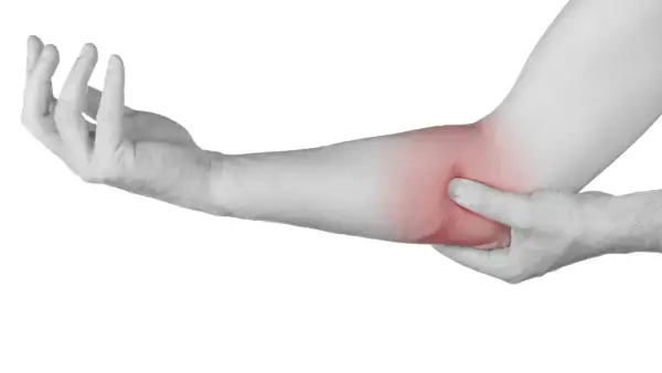 Brazo con zona enrojecida en el codo, indicando posible irritación del nervio cubital.