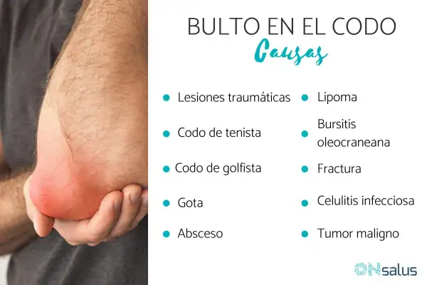 Un codo con un bulto rojo e inflamado. La imagen lista posibles causas de un bulto en el codo, como lipoma, bursitis o fractura.