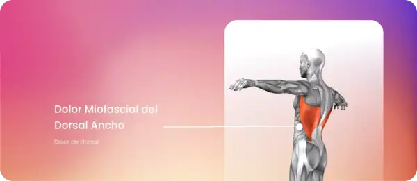 Anatomía del dolor miofascial en el dorsal ancho, mostrando el músculo resaltado en rojo.