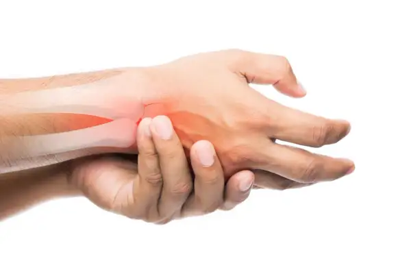 Mano con hueso resaltado en rojo, indicando posible fractura de dedo. El tiempo de recuperación es clave.